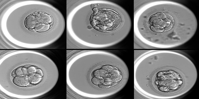 AI embryo selection in 2026: what IVF patients should actually know