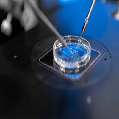 Conception calculator